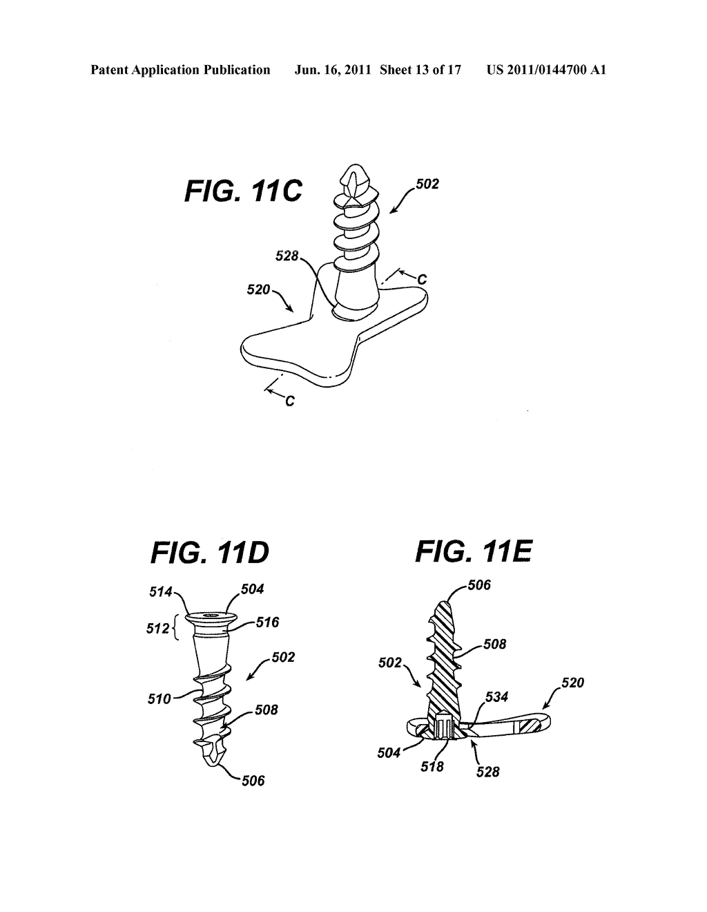 RESILIENT BONE PLATE AND SCREW SYSTEM ALLOWING BI-DIRECTIONAL ASSEMBLY - diagram, schematic, and image 14