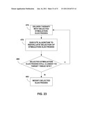 STIMULATION ELECTRODE SELECTION diagram and image
