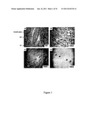 COMPOSITION AND METHOD FOR THE TREATMENT OR PREVENTION OF SPINAL DISORDERS diagram and image