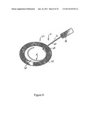 COMPOSITION AND METHOD FOR THE TREATMENT OR PREVENTION OF SPINAL DISORDERS diagram and image