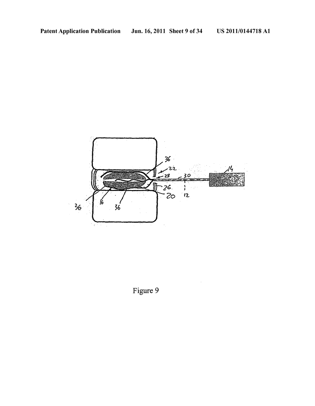 COMPOSITION AND METHOD FOR THE TREATMENT OR PREVENTION OF SPINAL DISORDERS - diagram, schematic, and image 10