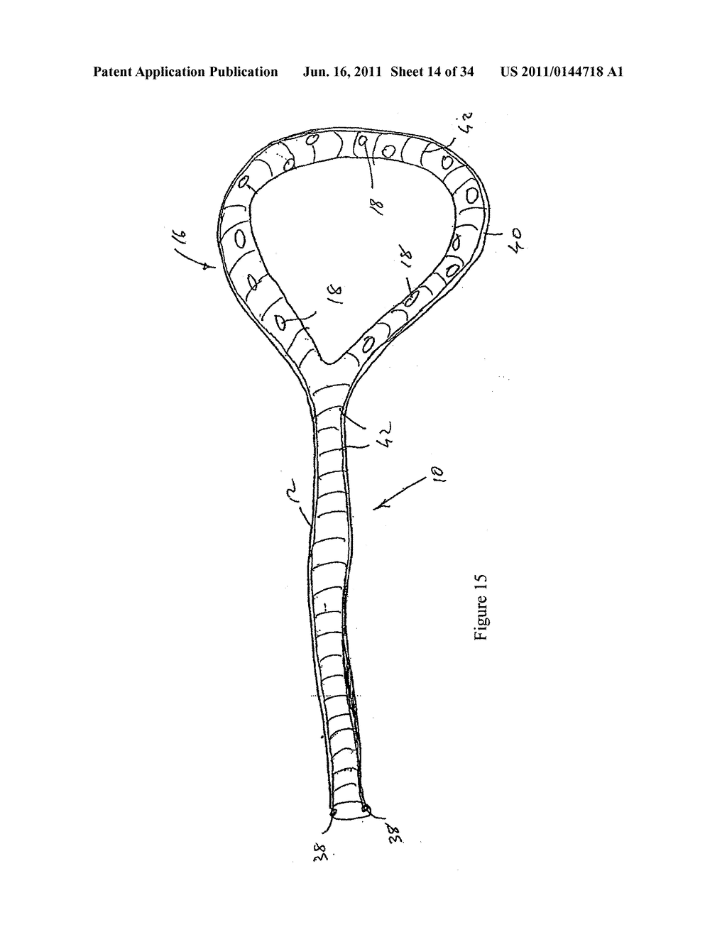 COMPOSITION AND METHOD FOR THE TREATMENT OR PREVENTION OF SPINAL DISORDERS - diagram, schematic, and image 15