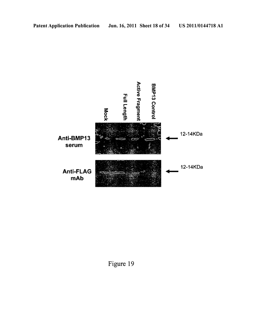 COMPOSITION AND METHOD FOR THE TREATMENT OR PREVENTION OF SPINAL DISORDERS - diagram, schematic, and image 19