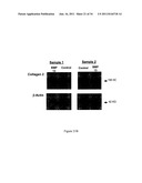 COMPOSITION AND METHOD FOR THE TREATMENT OR PREVENTION OF SPINAL DISORDERS diagram and image