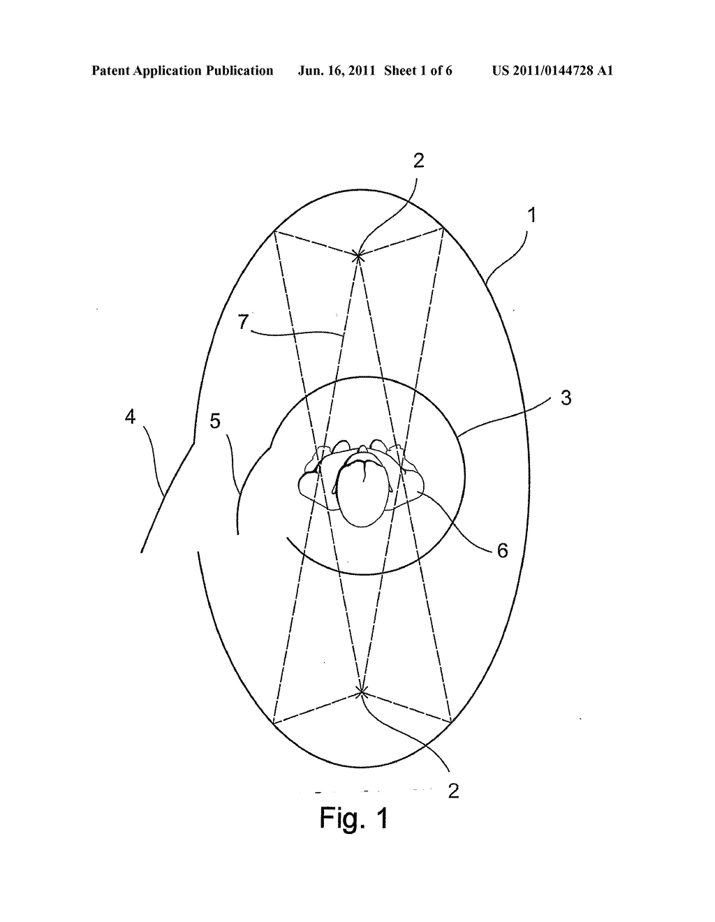 TANNING LAMP ARRANGEMENT - diagram, schematic, and image 02