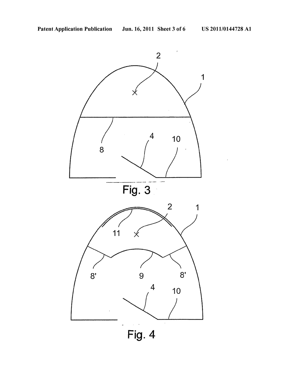 TANNING LAMP ARRANGEMENT - diagram, schematic, and image 04