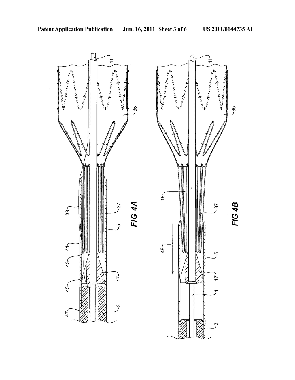 INTRODUCER - diagram, schematic, and image 04