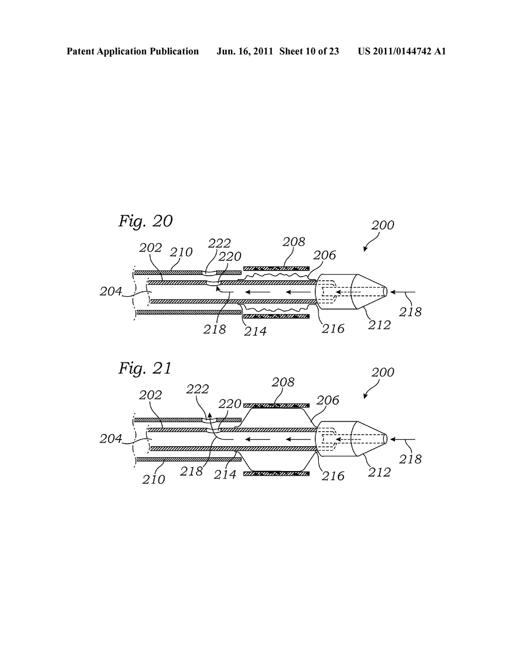 Expansion Device for Treatment of Vascular Passageways - diagram, schematic, and image 11