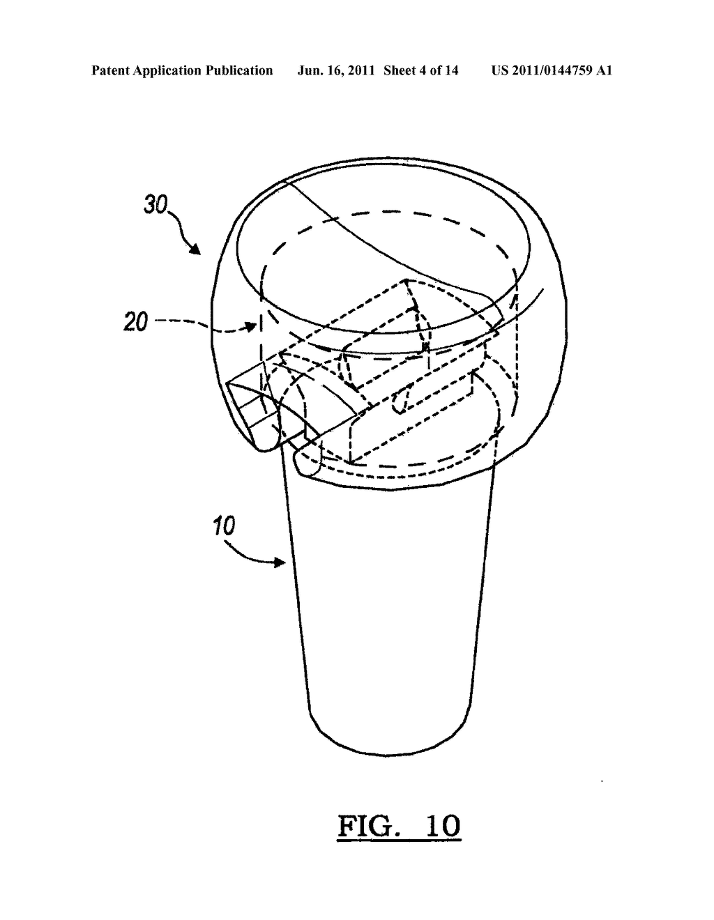 MODULAR PROSTHESIS AND USE THEREOF FOR REPLACING A RADIAL HEAD - diagram, schematic, and image 05