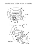 MODULAR PROSTHESIS AND USE THEREOF FOR REPLACING A RADIAL HEAD diagram and image