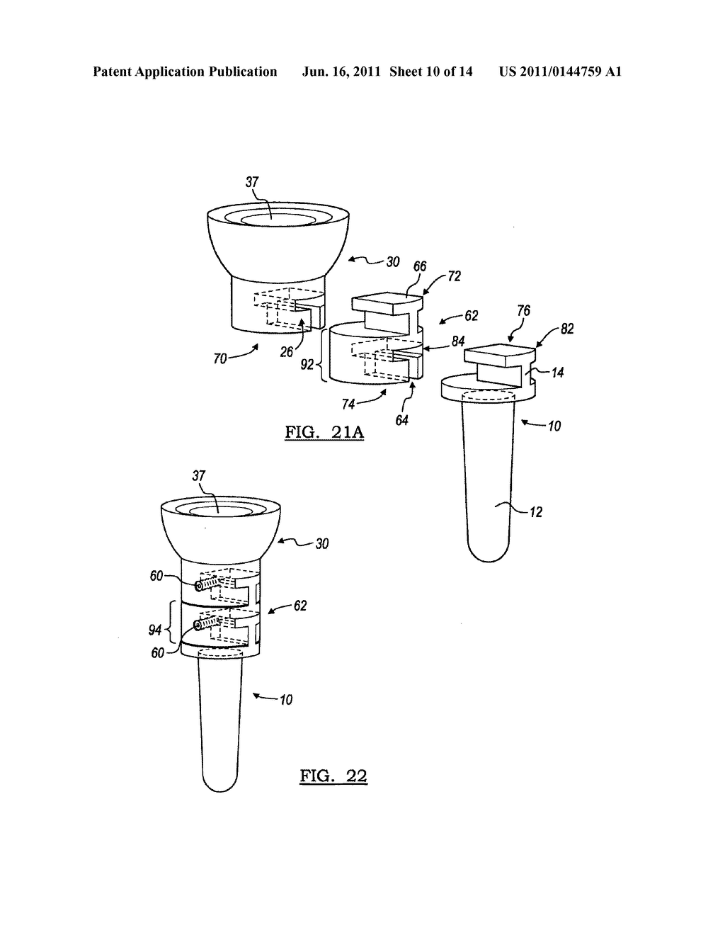 MODULAR PROSTHESIS AND USE THEREOF FOR REPLACING A RADIAL HEAD - diagram, schematic, and image 11