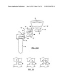 MODULAR PROSTHESIS AND USE THEREOF FOR REPLACING A RADIAL HEAD diagram and image