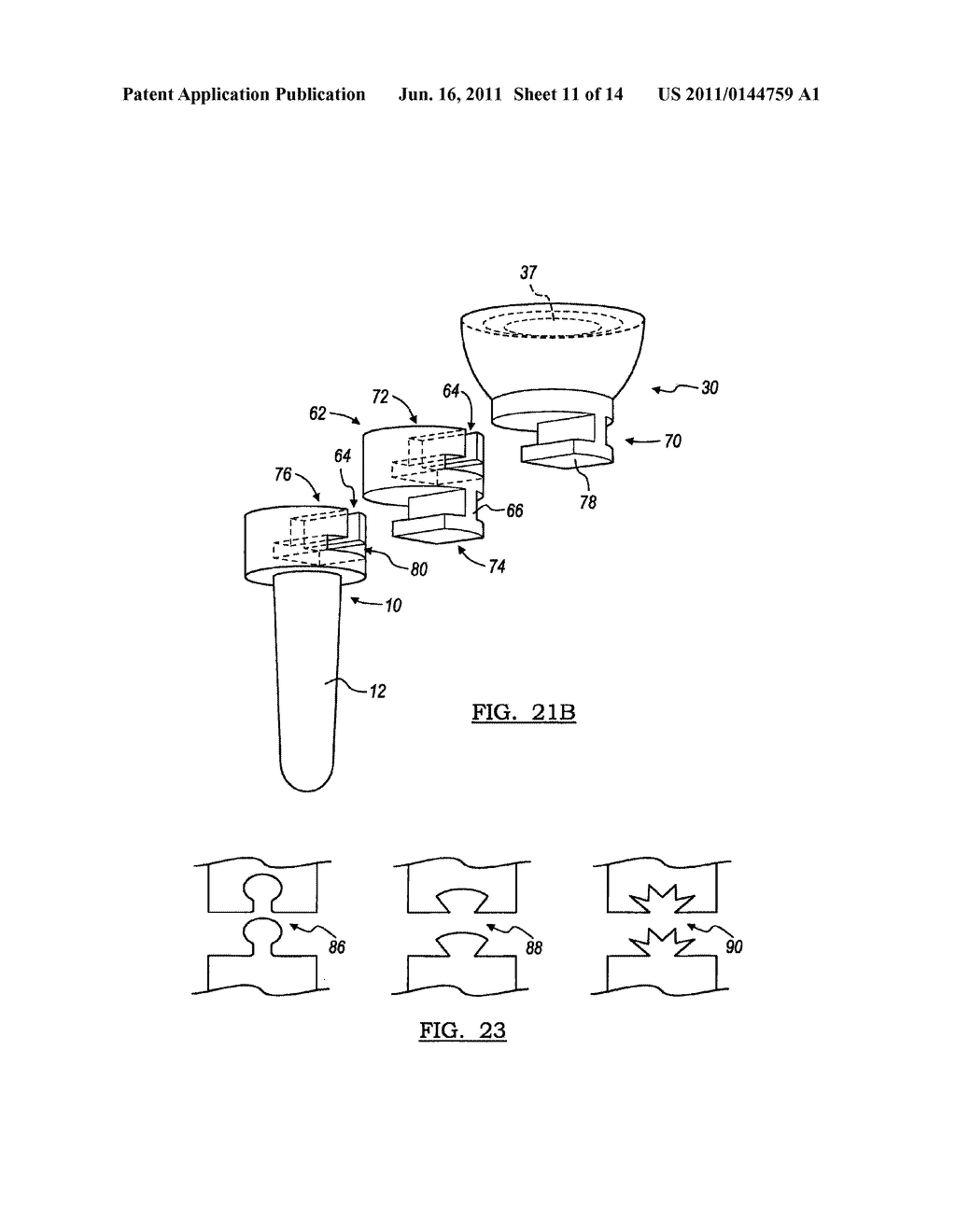 MODULAR PROSTHESIS AND USE THEREOF FOR REPLACING A RADIAL HEAD - diagram, schematic, and image 12