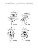 MODULAR PROSTHESIS AND USE THEREOF FOR REPLACING A RADIAL HEAD diagram and image