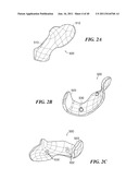 Patient-Specific and Patient-Engineered Orthopedic Implants diagram and image