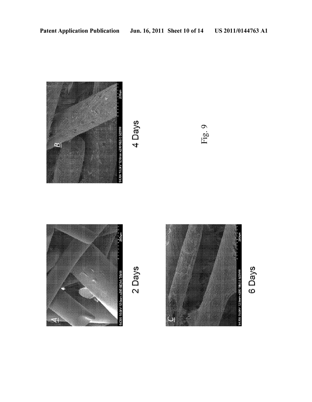 DYNAMIC BIOACTIVE BONE GRAFT MATERIAL HAVING AN ENGINEERED POROSITY - diagram, schematic, and image 11