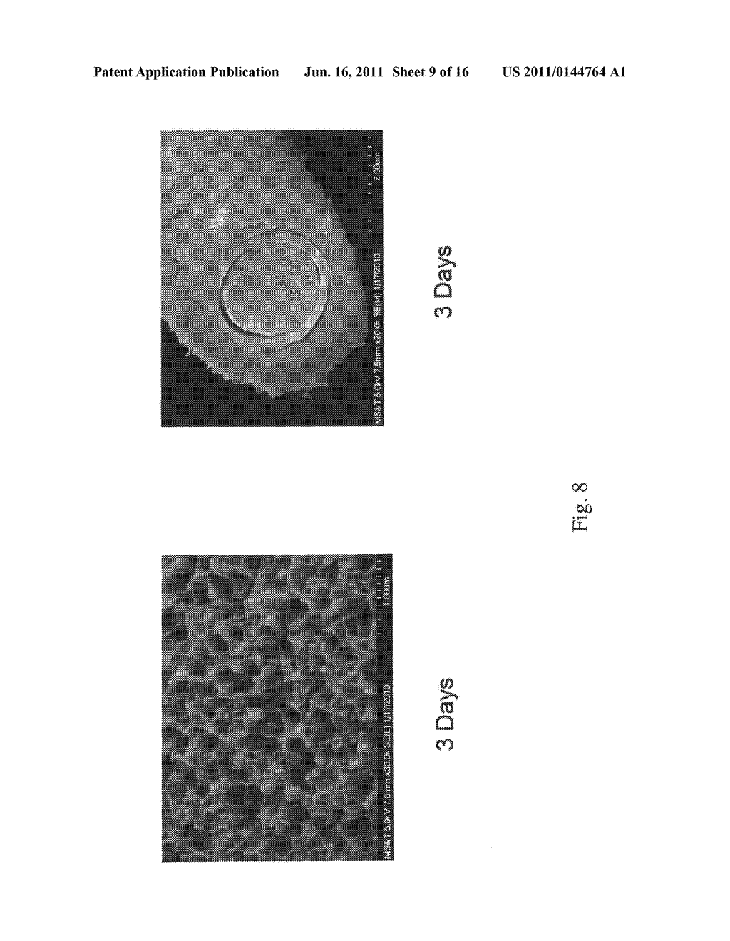 BONE GRAFT MATERIAL - diagram, schematic, and image 10