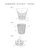 Device and method for securing an attachment device for a prosthesis     and/or a prosthesis adapter to a prosthesis shaft and protective lining diagram and image