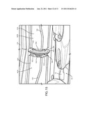 Wide Cut Rotary Harvester With Improved Helper Roll diagram and image