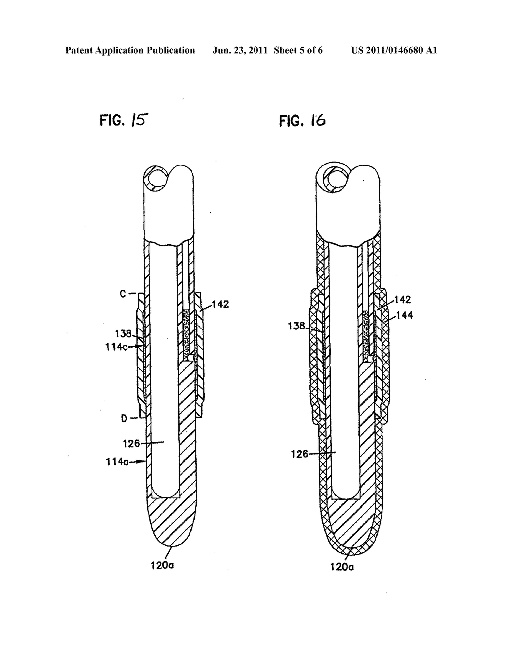 SILICONE CATHETER CONTAINING CHLORHEXIDINE GLUCONATE - diagram, schematic, and image 06