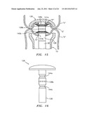 STRUCTURE FOR APPLYING SPRAYABLE WOUND TREATMENT MATERIAL diagram and image