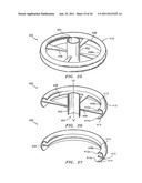 STRUCTURE FOR APPLYING SPRAYABLE WOUND TREATMENT MATERIAL diagram and image