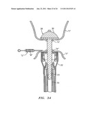 STRUCTURE FOR APPLYING SPRAYABLE WOUND TREATMENT MATERIAL diagram and image