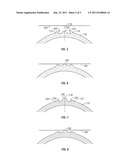 HIGH EXPANSION METALLIC SEAL diagram and image