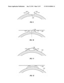 HIGH EXPANSION METALLIC SEAL diagram and image