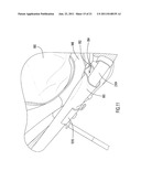 Collapsible Infant Support diagram and image