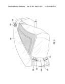 Collapsible Infant Support diagram and image