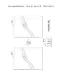 SYSTEM AND METHOD FOR DENSE-STOCHASTIC-SAMPLING IMAGING diagram and image