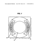 STABILIZATION OF CONTACT LENSES diagram and image