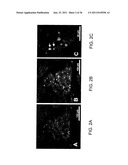 METHOD AND APPARATUS FOR OPTICAL IMAGING VIA SPECTRAL ENCODING diagram and image