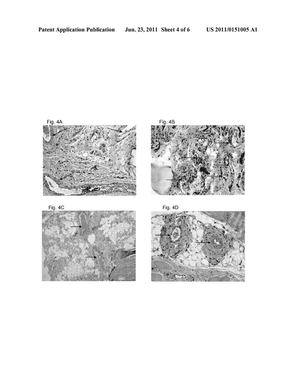 METHODS AND MEANS FOR SOFT TISSUE ENGINEERING - diagram, schematic, and image 05