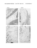 METHODS AND MEANS FOR SOFT TISSUE ENGINEERING diagram and image