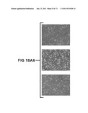 ACTIVE SUBSTANCE COMBINATION WITH GEMCITABINE FOR THE TREATMENT OF     EPITHELIAL CANCER diagram and image