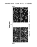 ACTIVE SUBSTANCE COMBINATION WITH GEMCITABINE FOR THE TREATMENT OF     EPITHELIAL CANCER diagram and image