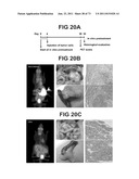 ACTIVE SUBSTANCE COMBINATION WITH GEMCITABINE FOR THE TREATMENT OF     EPITHELIAL CANCER diagram and image