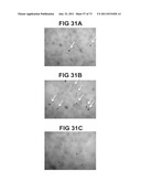 ACTIVE SUBSTANCE COMBINATION WITH GEMCITABINE FOR THE TREATMENT OF     EPITHELIAL CANCER diagram and image