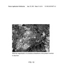 STRONTIUM-DOPED CALCIUM PHOSPHATE BONE GRAFT MATERIALS diagram and image