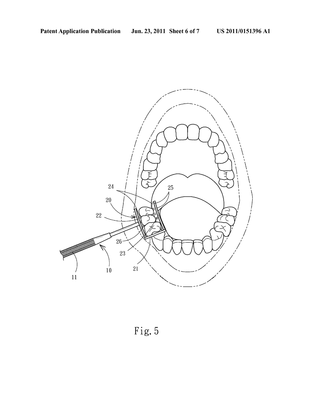 TONGUE ISOLATOR EQUIPPED WITH LIGHTING - diagram, schematic, and image 07