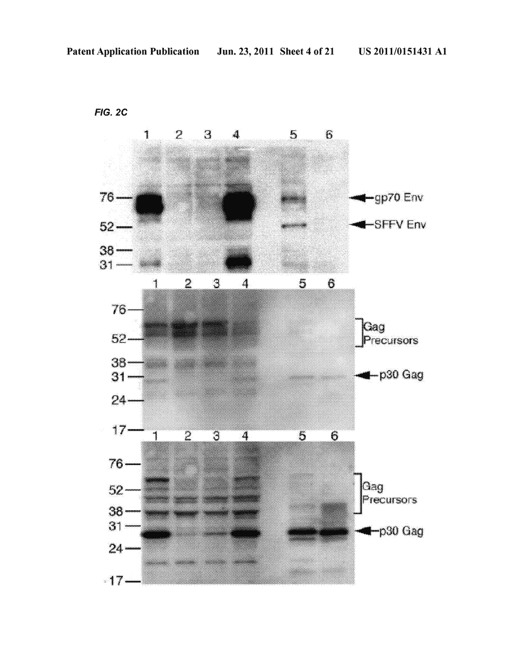 DETECTION OF XENOTROPIC MURINE LEUKEMIA VIRUS - diagram, schematic, and image 05