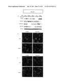 Gene expression markers of tumor resistance to HER2 inhibitor treatment diagram and image