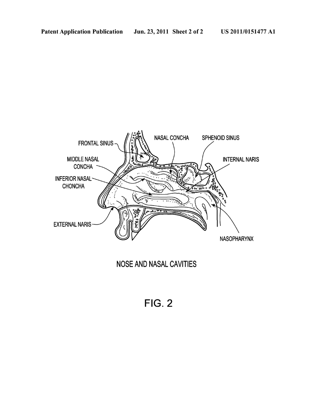 METHODS FOR DETECTING ANTIBODIES IN MUCOSAL SAMPLES AND DEVICE FOR     SAMPLING MUCOSAL MATERIAL - diagram, schematic, and image 03