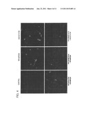 METHOD FOR SCREENING FOR ANTIANGIOGENIC AGENT, AND METHOD FOR SCREENING     FOR ANTIANGIOGENIC SIGNAL GENE diagram and image