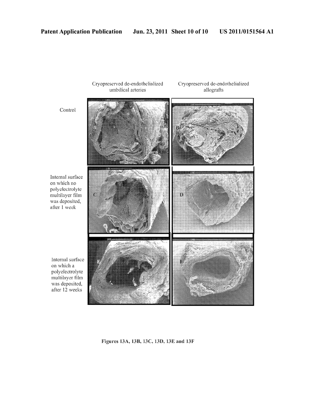 METHOD FOR PROLIFERATION OF CELLS ON POLYELECTROLYTE MULTILAYER FILMS AND     USE THEREOF, PARTICULARLY FOR THE PREPARATION OF CELLULAR BIOMATERIALS - diagram, schematic, and image 11