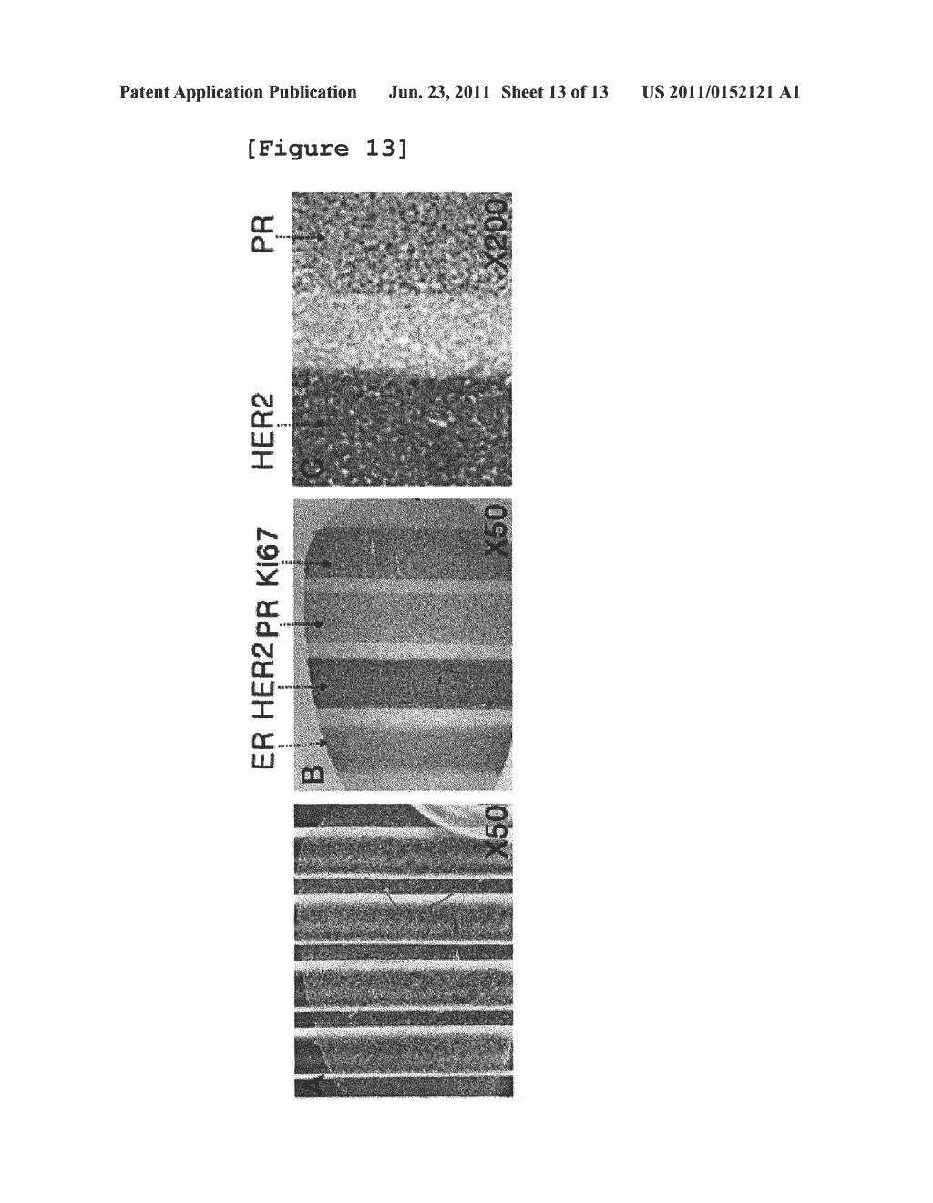 APPARATUS AND METHOD FOR MULTIPLE IMMUNOASSAYS ON A CHIP - diagram, schematic, and image 14