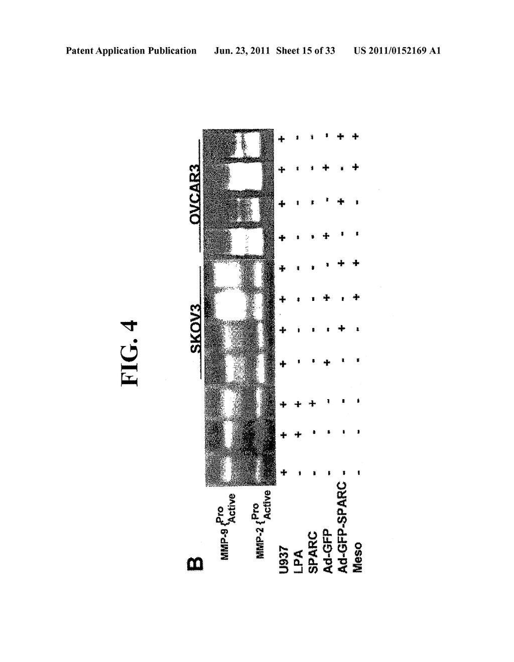 SPARC ANTI-INFLAMMATORY ACTIVITY AND USES THEREOF - diagram, schematic, and image 16