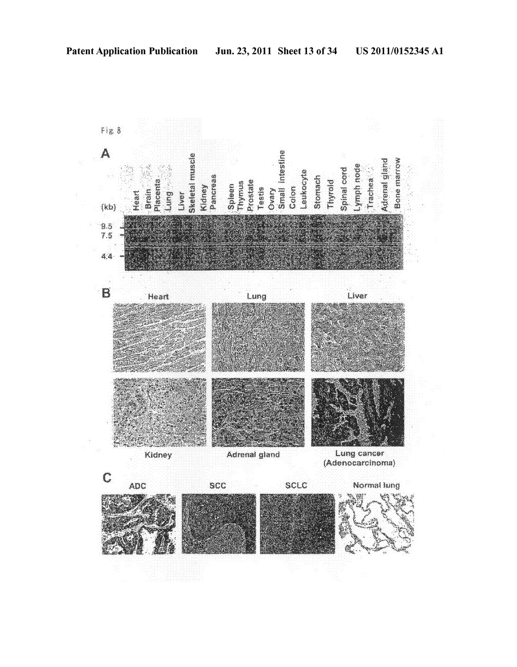 EBI3, DLX5, NPTX1 AND CDKN3 FOR TARGET GENES OF LUNG CANCER THERAPY AND     DIAGNOSIS - diagram, schematic, and image 14